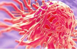 HPV3大辅助检测方法