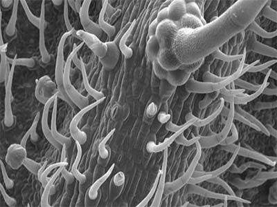 江西尖锐湿疣医院手术