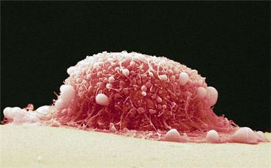 南昌男性生殖器疱疹医院临床的症状